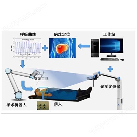 上海形展科技呼吸运动动态跟踪技术的导航系统